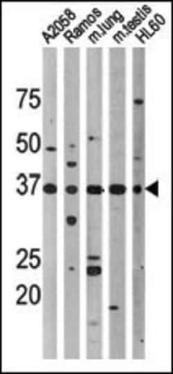 Invitrogen Phospho-p53 (Thr18) Polyclonal Antibody 400 &mu;L; Unconjugated:Antibodies,