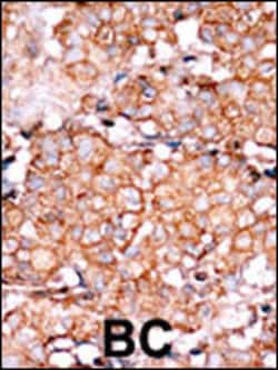 Invitrogen Phospho-RAD9 (Ser328) Polyclonal Antibody 400 &mu;L; Unconjugated:Antibodies,