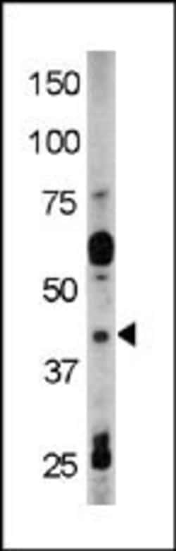 Invitrogen Phospho-RAD9 (Tyr28) Polyclonal Antibody 400 &mu;L; Unconjugated:Antibodies,