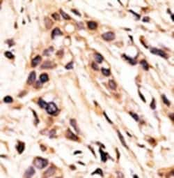 Invitrogen Phospho-Rb (Ser608) Polyclonal Antibody 400 &mu;L; Unconjugated:Antibodies,