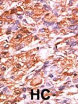 Invitrogen Phospho-Rb (Ser811) Polyclonal Antibody 400 &mu;L | Buy Online | Invitrogen&trade; | Fisher Scientific
