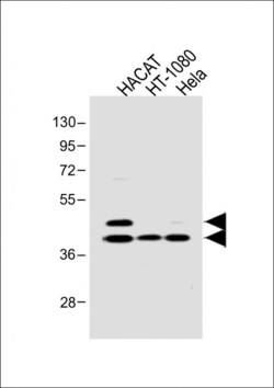 Invitrogen Phospho-SMAD3 (Ser213) Polyclonal Antibody 400 &mu;L; Unconjugated:Anticuerpos