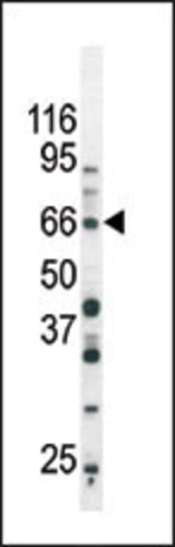 Invitrogen Phospho-SMAD3 (Ser213) Polyclonal Antibody 400 &mu;L; Unconjugated:Anticuerpos