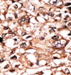 Invitrogen Phospho-TNFR1 (Ser274) Polyclonal Antibody 400 &mu;L; Unconjugated:Antibodies,