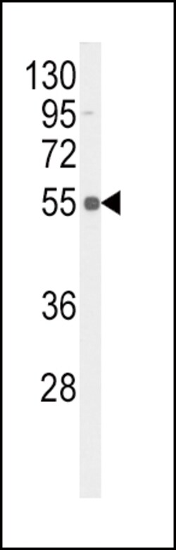 Invitrogen Phospho-TNFR1 (Ser274) Polyclonal Antibody 400 &mu;L; Unconjugated:Antibodies,