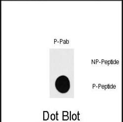 Invitrogen Phospho-p70 S6 Kinase (Ser418) Polyclonal Antibody 400 &mu;L;