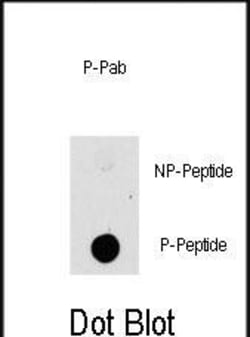 Invitrogen Phospho-TPL2 (Thr290) Polyclonal Antibody 400 &mu;L; Unconjugated:Antibodies,