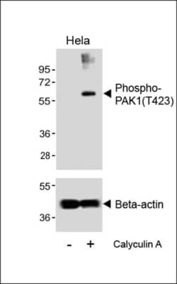 Invitrogen Phospho-PAK1 (Thr423) Polyclonal Antibody 400 &mu;L; Unconjugated:Antibodies,