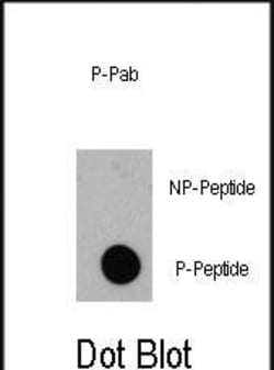Invitrogen Phospho-4EBP1 (Thr36) Polyclonal Antibody 400 &mu;L; Unconjugated:Antibodies,