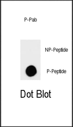 Invitrogen Phospho-TSC2 (Ser664) Polyclonal Antibody 400 &mu;L; Unconjugated:Antibodies,