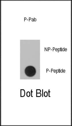 Invitrogen Phospho-RSK1 (Ser363) Polyclonal Antibody 400 &mu;L; Unconjugated:Antibodies,