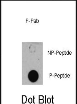 Invitrogen Phospho-TSC1 (Ser505) Polyclonal Antibody 400 &mu;L; Unconjugated:Antibodies,
