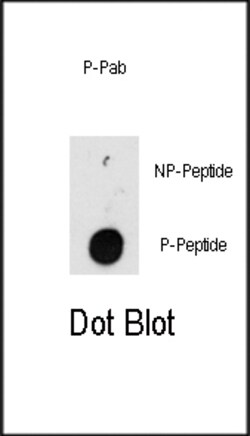 Invitrogen Phospho-ILK (Thr173) Polyclonal Antibody 400 &mu;L; Unconjugated:Antibodies,