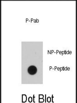 Invitrogen Phospho-EGFR (Tyr1016) Polyclonal Antibody 400 &mu;L; Unconjugated:Antibodies,