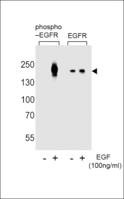 Invitrogen Phospho-EGFR (Tyr1016) Polyclonal Antibody 400 &mu;L; Unconjugated:Antibodies,