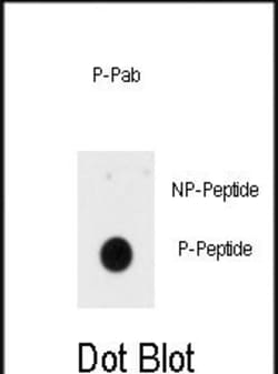 Invitrogen Phospho-INSR (Tyr1185) Polyclonal Antibody 400 &mu;L; Unconjugated:Antibodies,