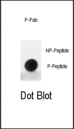 Invitrogen Phospho-MDM2 (Ser395) Polyclonal Antibody 400 &mu;L; Unconjugated:Antibodies,