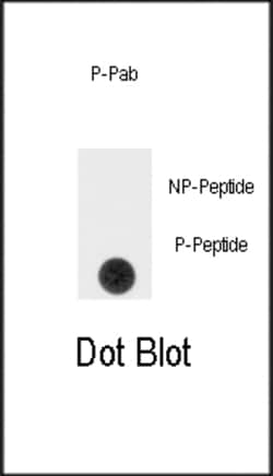 Invitrogen Phospho-SPRY4 (Tyr75) Polyclonal Antibody 400 &mu;L; Unconjugated:Antibodies,