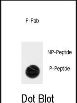Invitrogen Phospho-ACK1 (Tyr518) Polyclonal Antibody 400 &mu;L; Unconjugated:Antibodies,