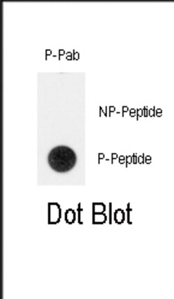 Invitrogen Phospho-TERT (Tyr707) Polyclonal Antibody 400 μL; Unconjugated:Antibodies,