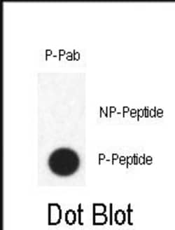 Invitrogen Phospho-FABP4 (Tyr20) Polyclonal Antibody 400 &mu;L; Unconjugated:Antibodies,