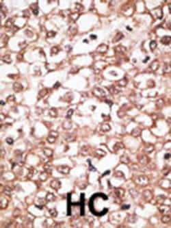 Invitrogen BSEP Polyclonal Antibody 400 &mu;L; Unconjugated:Antibodies,