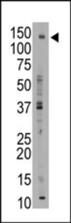 Invitrogen BSEP Polyclonal Antibody 400 &mu;L; Unconjugated:Antibodies,