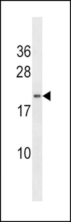 Invitrogen HAND2 Polyclonal Antibody 400 &mu;L | Buy Online | Invitrogen&trade; | Fisher Scientific