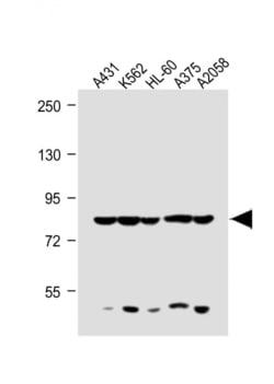 ABCB5 Polyclonal Antibody:Antibodies, Polyclonal