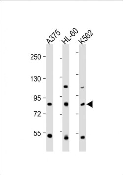 ABCB5 Polyclonal Antibody:Antibodies, Polyclonal