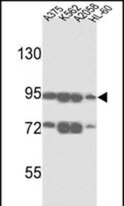 ABCB5 Polyclonal Antibody:Antibodies, Polyclonal
