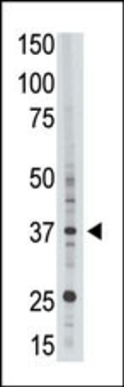 Invitrogen EPR1 Polyclonal Antibody 400 &mu;L; Unconjugated:Antibodies,