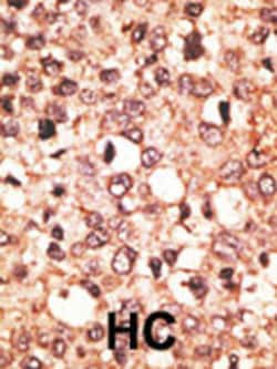Invitrogen CRY1 Polyclonal Antibody 400 &mu;L; Unconjugated:Antibodies,