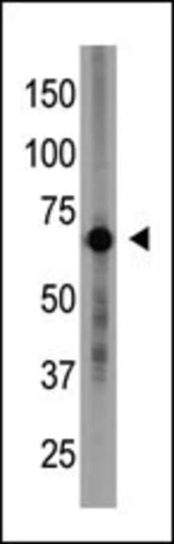 Invitrogen CRY1 Polyclonal Antibody 400 &mu;L; Unconjugated:Antibodies,