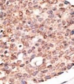 Invitrogen CRY2 Polyclonal Antibody 400 &mu;L; Unconjugated:Antibodies,