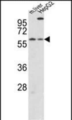 Invitrogen CRY2 Polyclonal Antibody 400 &mu;L; Unconjugated:Antibodies,
