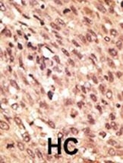 Invitrogen LRP5 Polyclonal Antibody 400 &mu;L; Unconjugated:Antibodies,