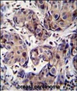 Invitrogen MAGEA3 Polyclonal Antibody 400 &mu;L | Buy Online | Invitrogen&trade; | Fisher Scientific