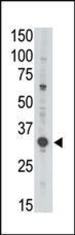 Invitrogen MAGEA3 Polyclonal Antibody 400 &mu;L | Buy Online | Invitrogen&trade; | Fisher Scientific