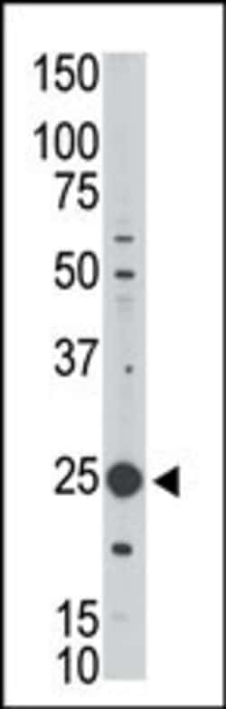 Invitrogen MAGEH1 Polyclonal Antibody 400 &mu;L; Unconjugated:Antibodies,