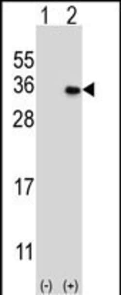 Invitrogen MAGEH1 Polyclonal Antibody 400 &mu;L; Unconjugated:Antibodies,