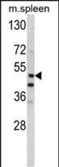 Invitrogen MMP10 Polyclonal Antibody 400 &mu;L; Unconjugated:Antibodies,