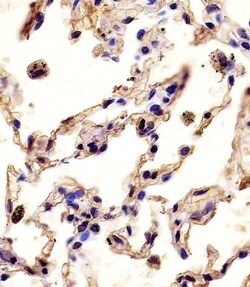 Invitrogen MMP12 Polyclonal Antibody 400 &mu;L; Unconjugated:Antibodies,