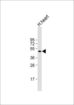 Invitrogen MMP12 Polyclonal Antibody 400 &mu;L; Unconjugated:Antibodies,