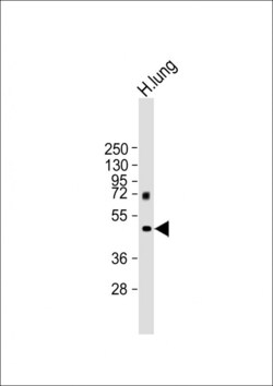 Invitrogen MMP12 Polyclonal Antibody 400 &mu;L; Unconjugated:Antibodies,