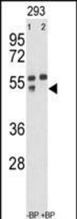 Invitrogen MMP12 Polyclonal Antibody 400 &mu;L; Unconjugated:Antibodies,