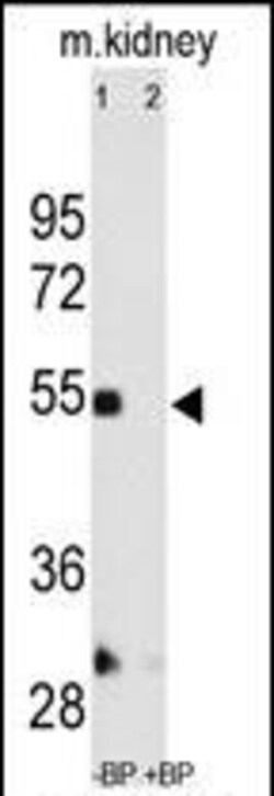 Invitrogen MMP12 Polyclonal Antibody 400 &mu;L; Unconjugated:Antibodies,