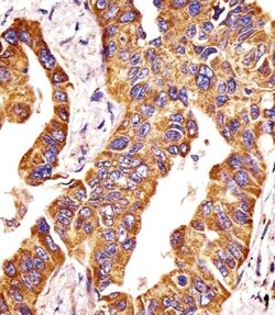Invitrogen MMP14 Polyclonal Antibody 400 &mu;L | Buy Online | Invitrogen&trade; | Fisher Scientific