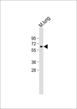 Invitrogen MMP14 Polyclonal Antibody 400 &mu;L | Buy Online | Invitrogen&trade; | Fisher Scientific