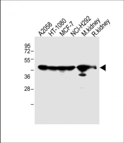 Invitrogen MMP14 Polyclonal Antibody 400 &mu;L | Buy Online | Invitrogen&trade; | Fisher Scientific